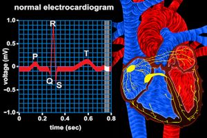 What does an electrocardiogram show?