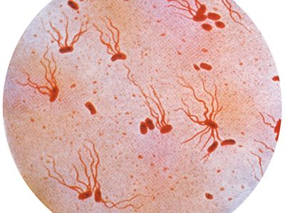 Salmonella Typhi