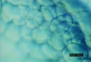See time-lapse microphotography of blastomeres created by mitotic cleavage of embryonic cells