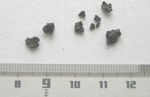 gallstone