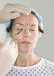 Botox injection
