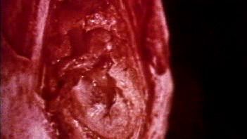 Watch sound wave vibrations in the tympanic membrane