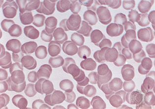 red blood cells