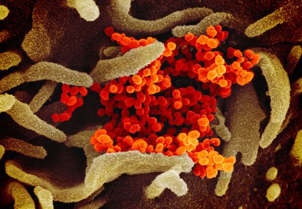 Novel Coronavirus SARS-CoV-2: Scanning electron microscope image shows SARS-CoV-2 (orange)-also known as 2019-nCoV, the virus that causes COVID-19 isolated from a patient in the U.S., emerging from the surface of cells (green) cultured in the lab.