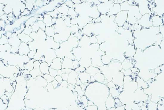 Normal lung tissue from a mouse.