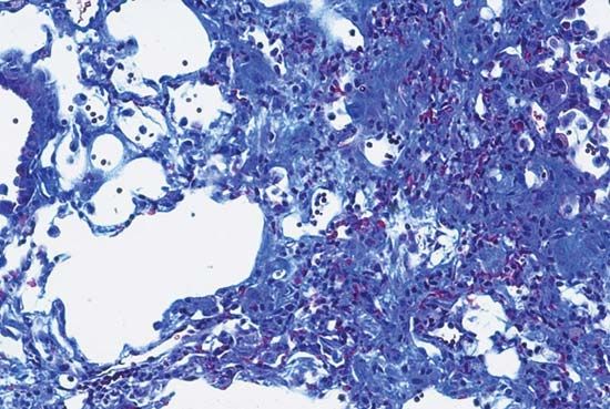 Fibrotic tissue isolated from the lung of a mouse.