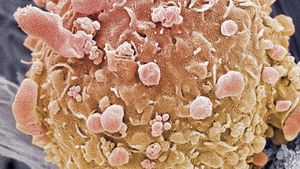 Understand how scientists understand and treat melanoma by targeting the gene B-Raf oncogene