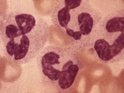 leukocytosis